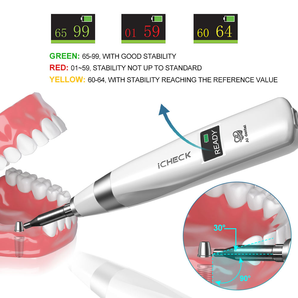 AI Dental Implant Stability Me - огляд і ціна Stabilizer Screw In