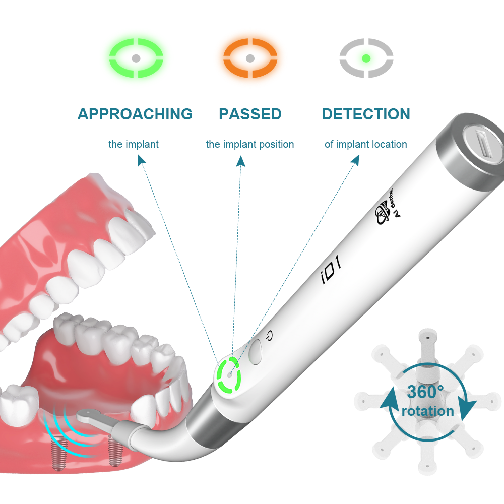 AI Dental Implant Stability Me - огляд і ціна Stabilizer Screw In
